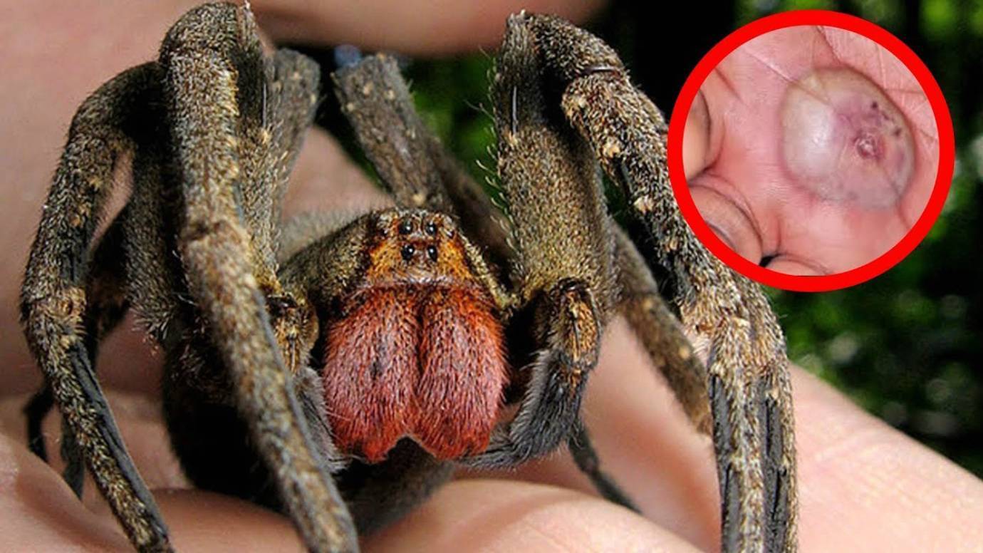 Ядовитые и не ядовитые пауки россии, какие из них самые опасные?