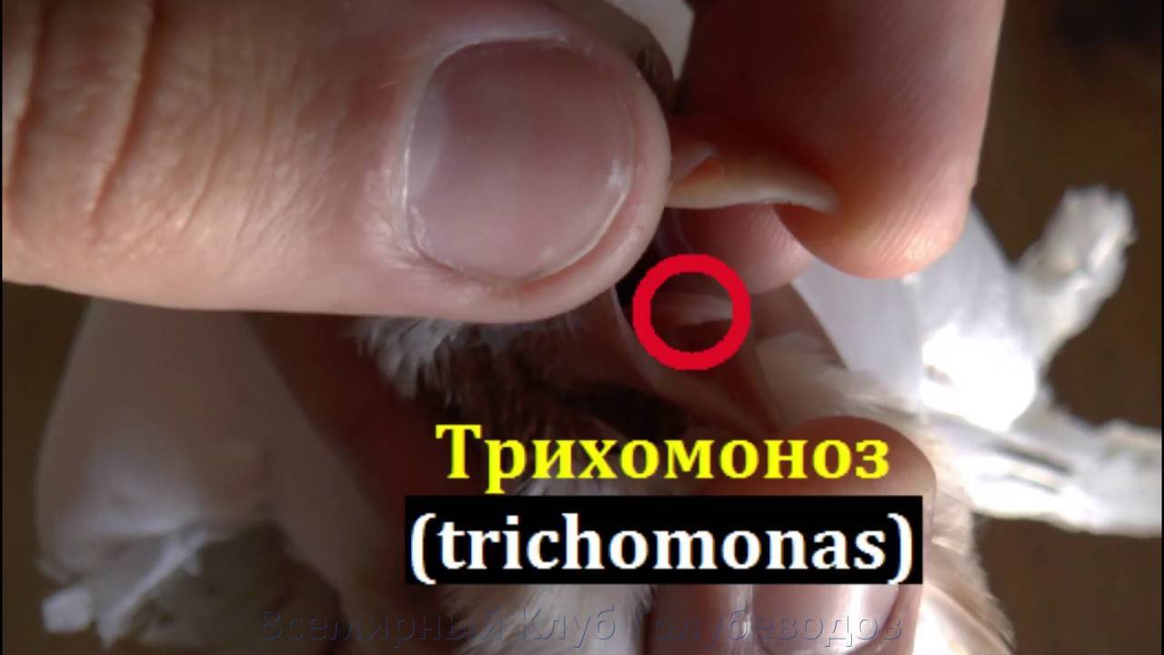 Трихомониаз у мужчин: симптомы и фото, схема лечения трихомониаза