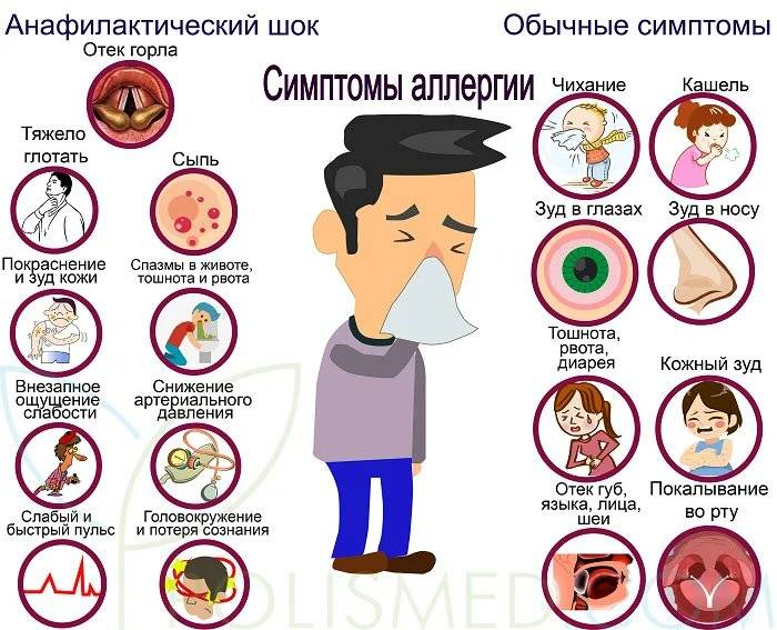 Гиперосмия - симптомы и причины