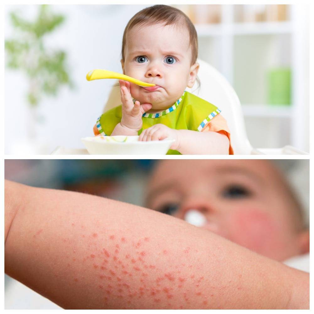 Аллергия на инфекцию. симптомы, причины и лечение аллергии на инфекцию