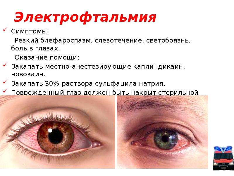 Когда бывают красные белки глаз у собаки? - kupipet.ru